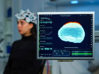 qeeg-brain-scan QEEG Brain map